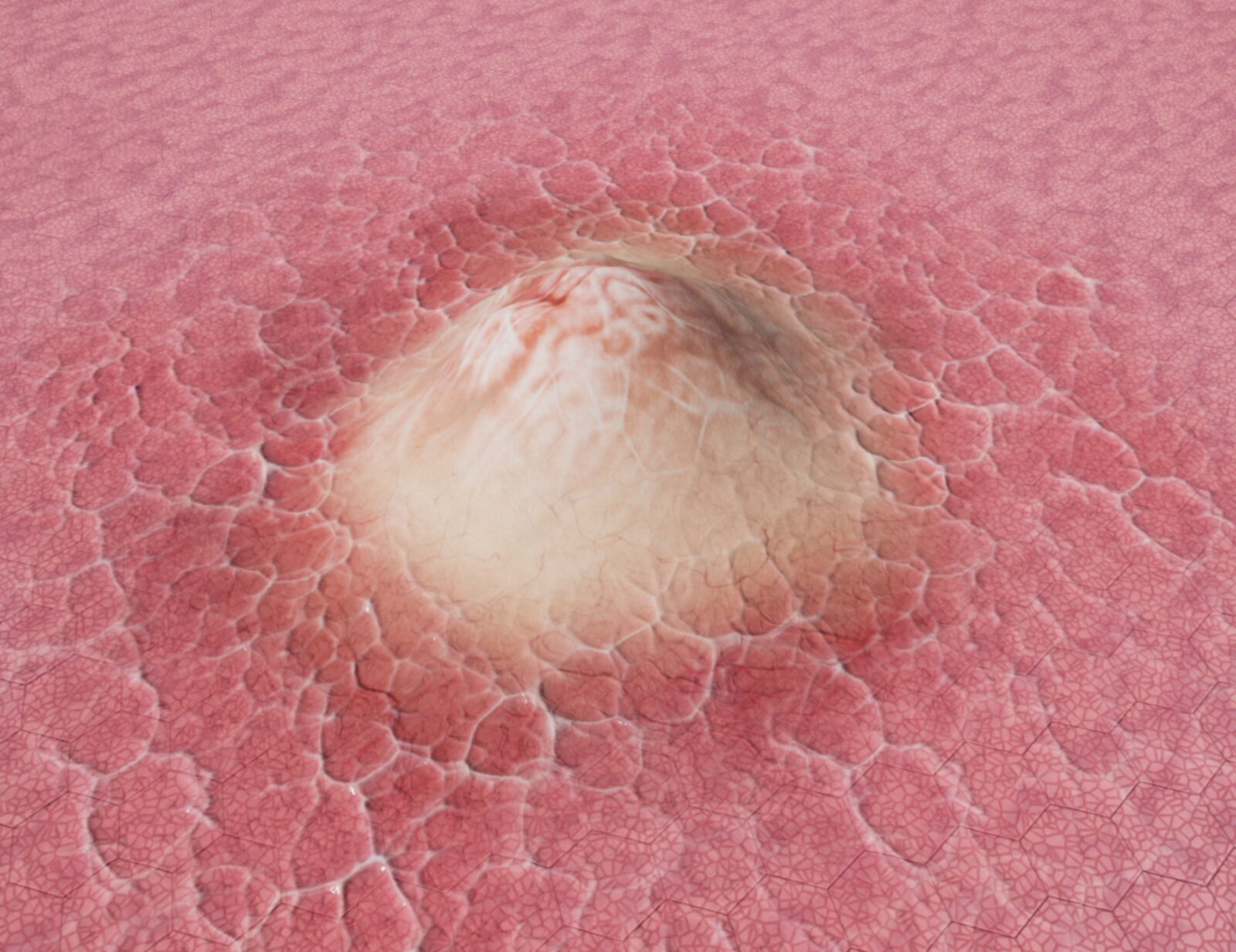 Tissue Mound